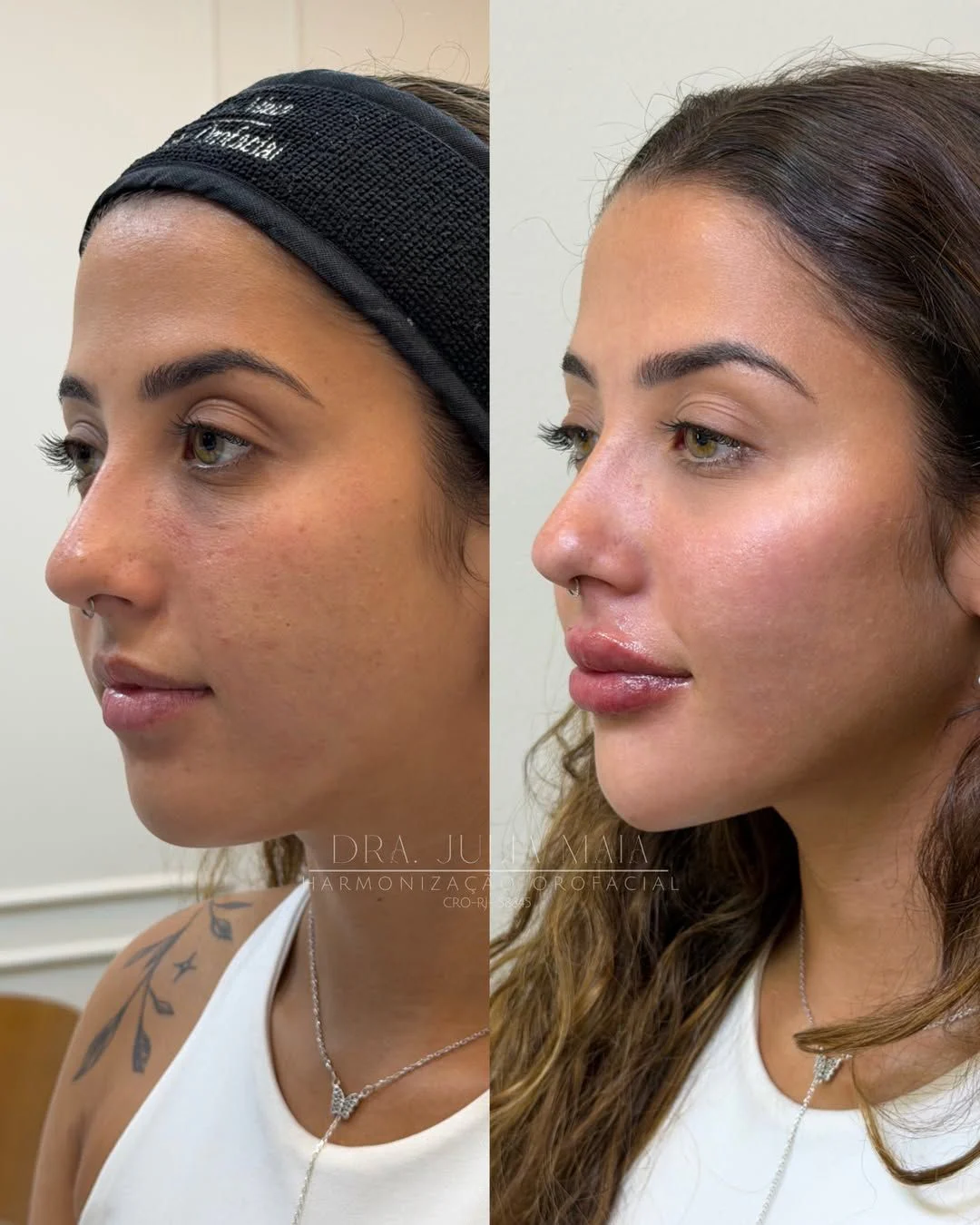 Perfil valorizado com naturalidade after